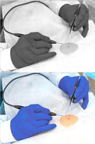 Skin & Soft Tissue Surgery provided by Oakland General Surgery • Einas Joseph, MD